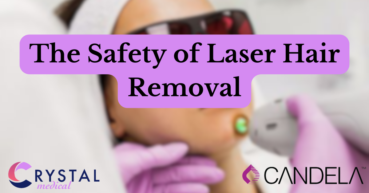 Candela Laser Hair Removal: Ensuring Safe and Effective Treatment