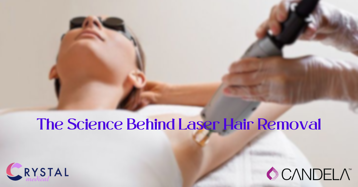 The Science Behind Laser Hair Removal
