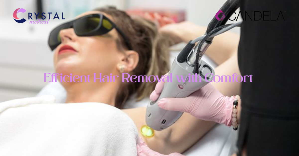 How Candela Lasers Improve Comfort and Results
