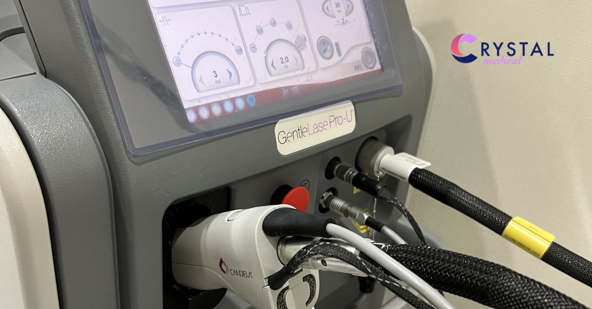 Why Calibration Matters: Ensuring Accuracy in Every Laser Pulse