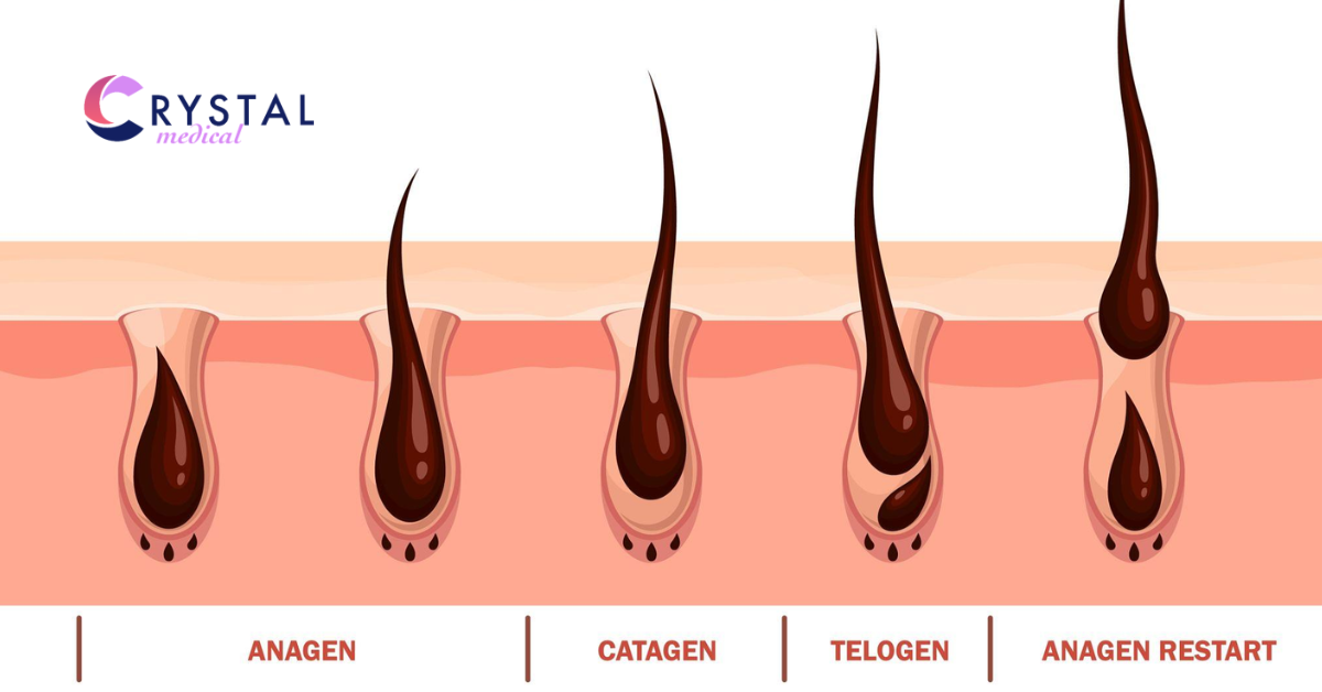 Why the Hair Growth Cycle Matters for Laser Hair Removal