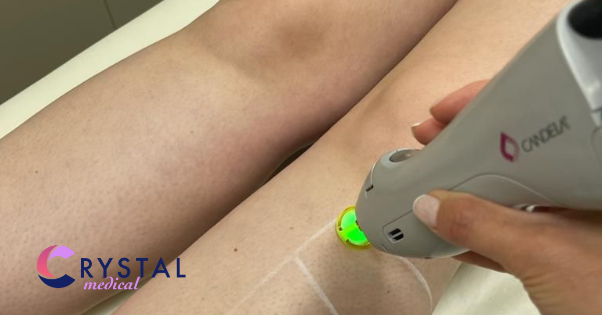 How Many Laser Hair Removal Sessions Do You Really Need?